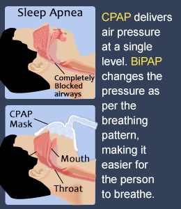 cpap vs bipap